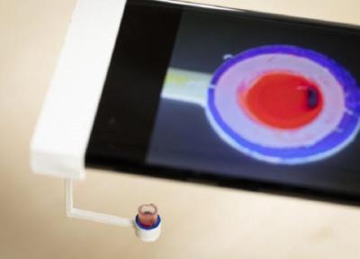 آنالیز لخته شدن خون با تلفن همراه!